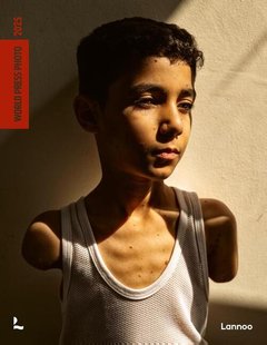 World Press Photo 2025