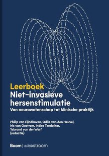 Niet-invasieve hersenstimulatie