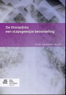 De thoraxfoto