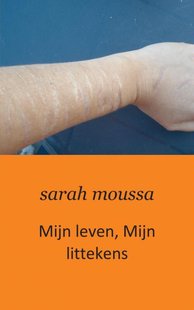 Mijn leven, mijn littekens