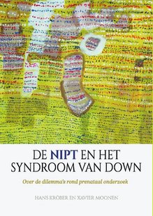 De NIPT en het syndroom van Down